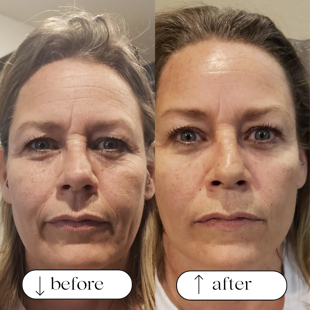 Age-Reversing Whipped Tallow Cream