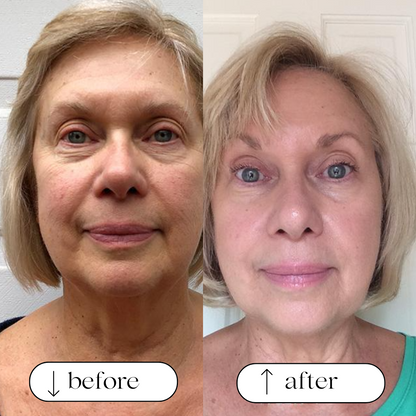 Age-Reversing Whipped Tallow Cream